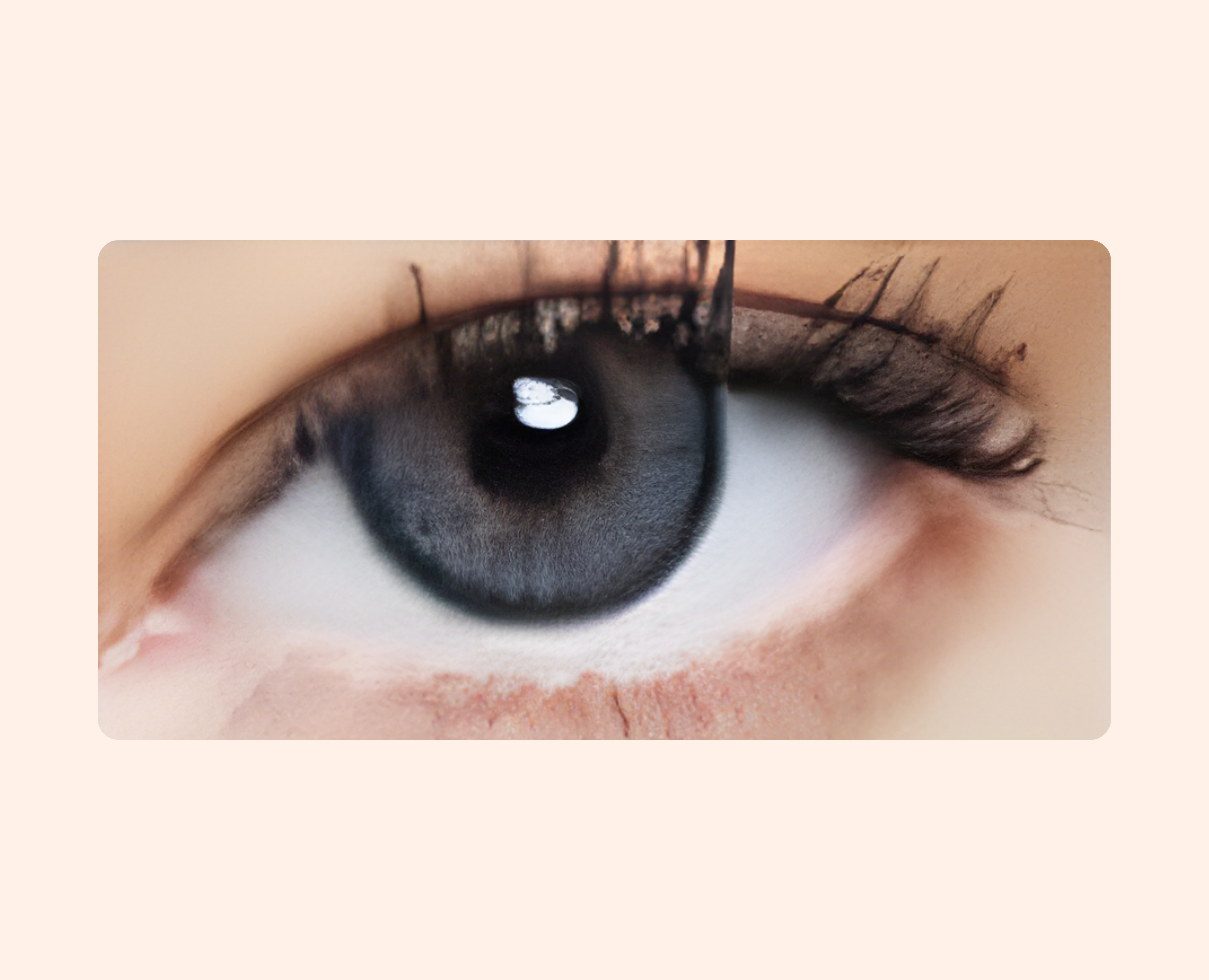 Eye Dia Conventional - Blue