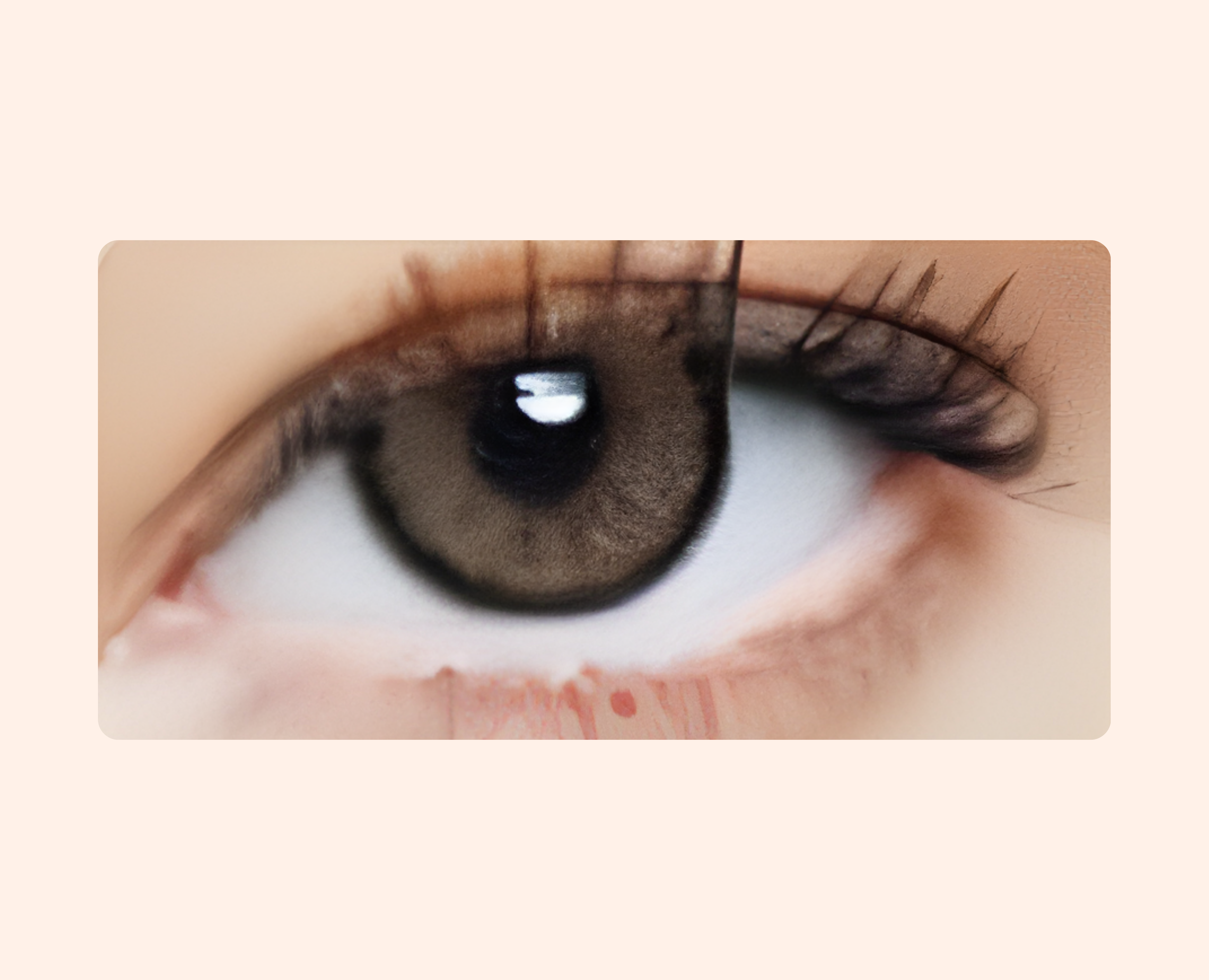 Eye Dia Conventional - Choco