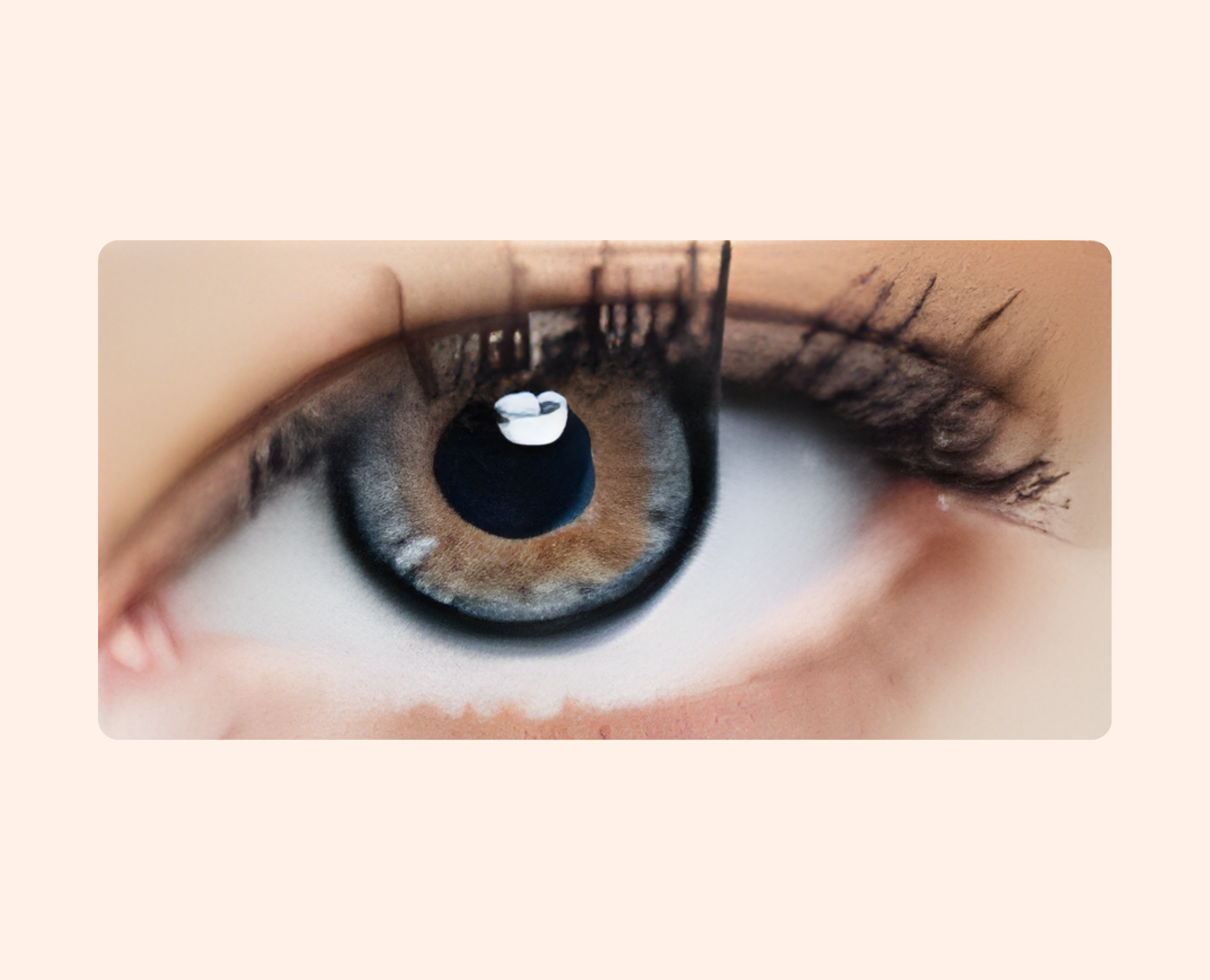 Eye Dia Conventional - Dark Gray