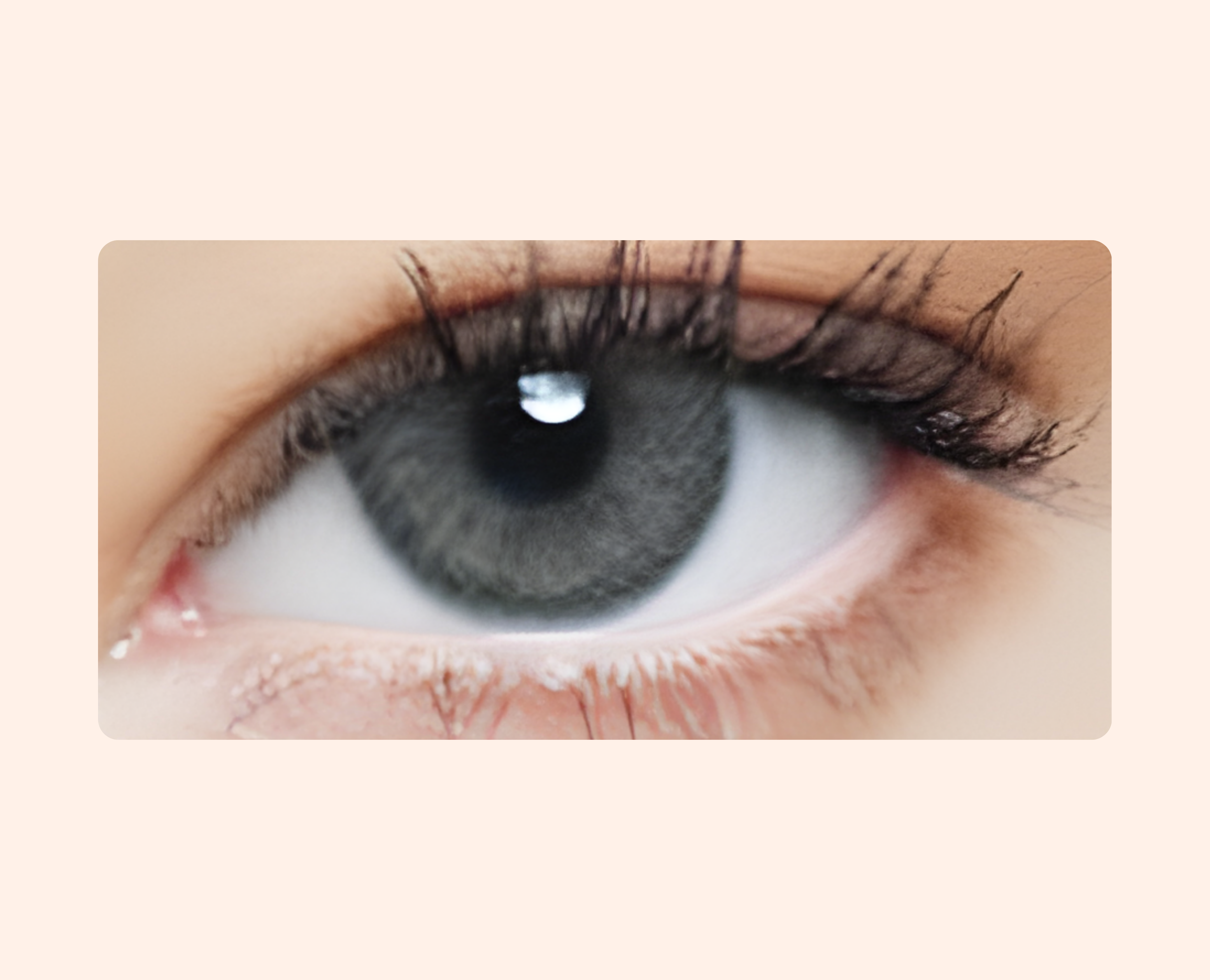 Eye Dia Conventional - Grafit