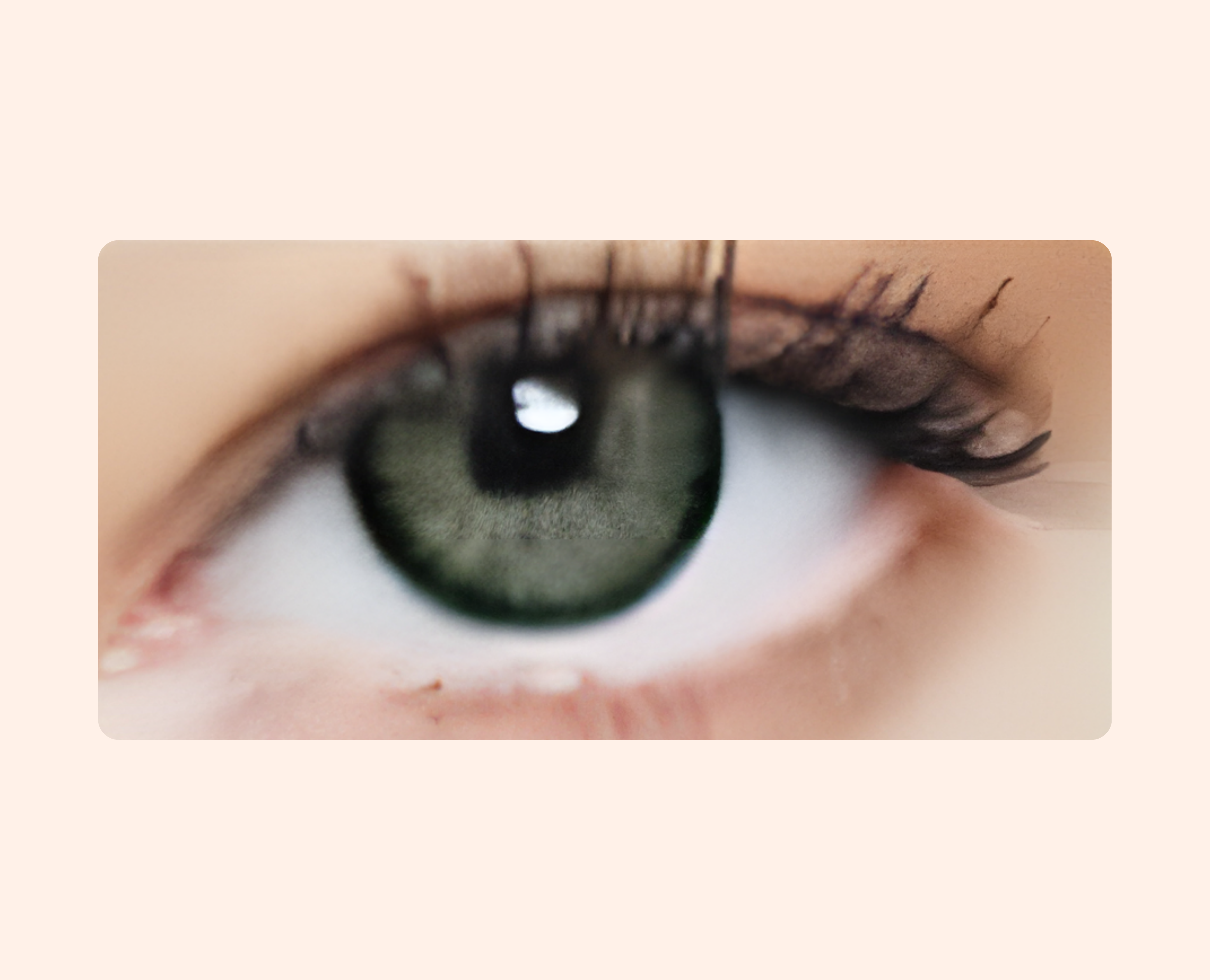 Eye Dia Conventional - Gray Green