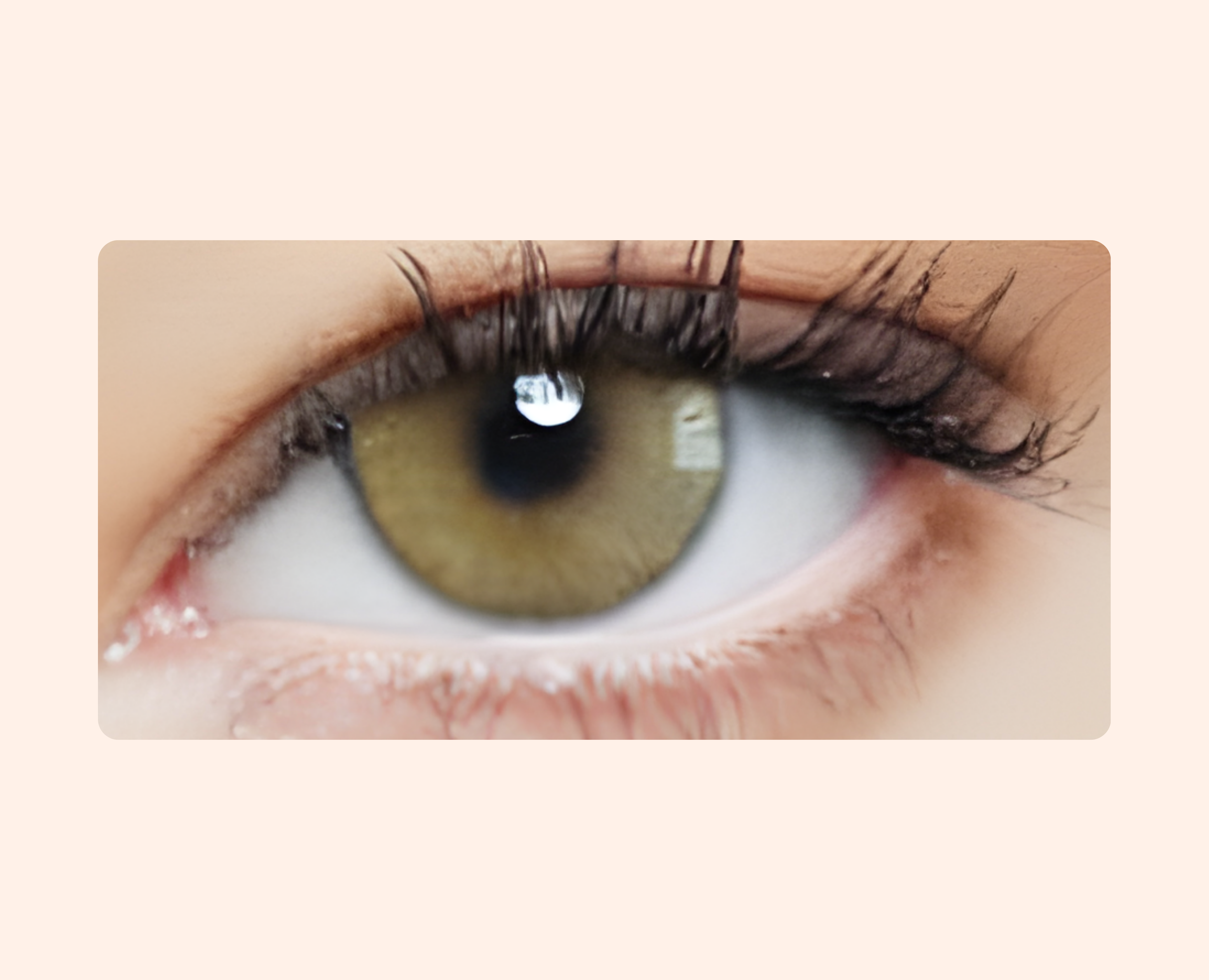 Eye Dia Conventional - Ocre