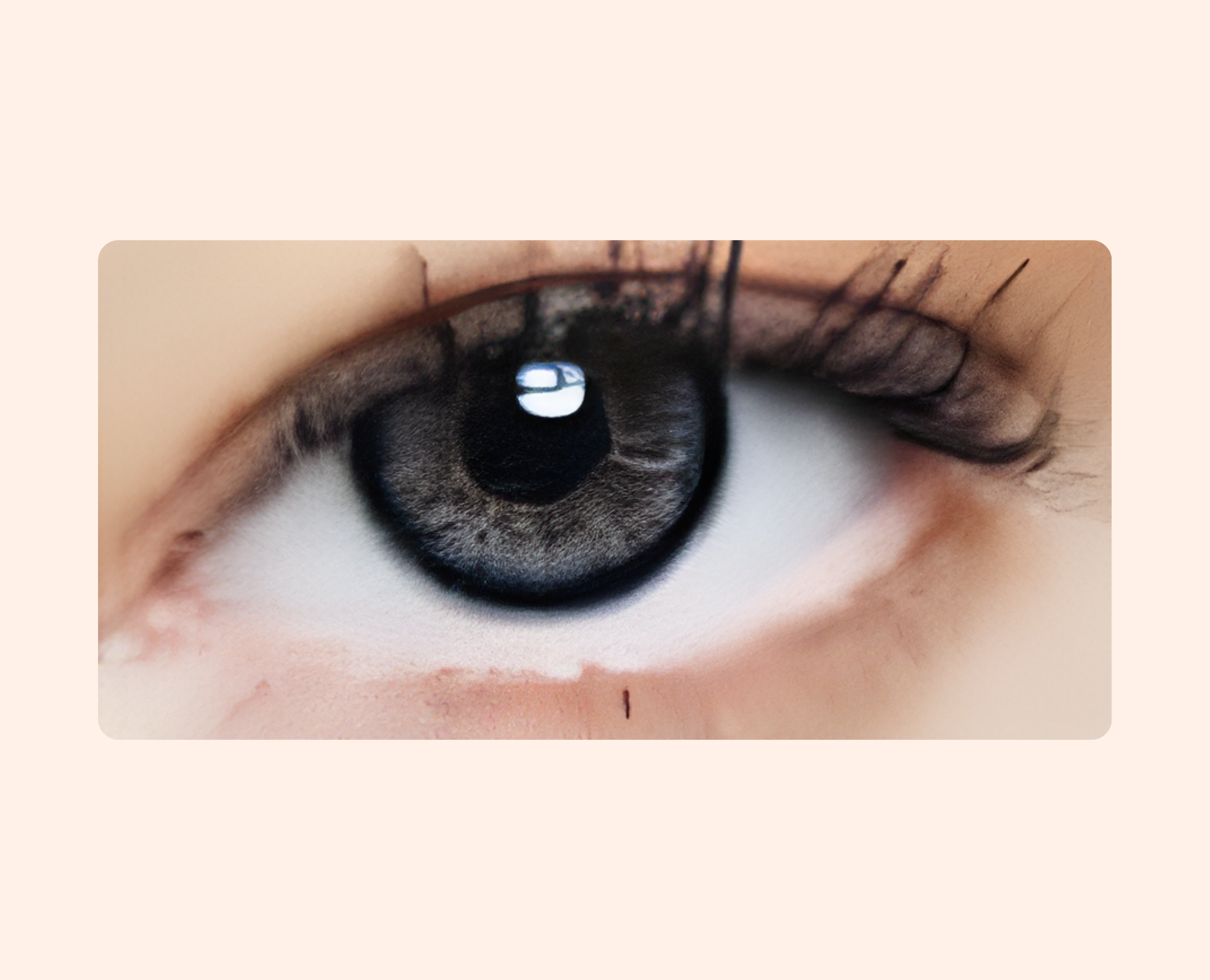 Eye Dia Conventional - Platinum Gray