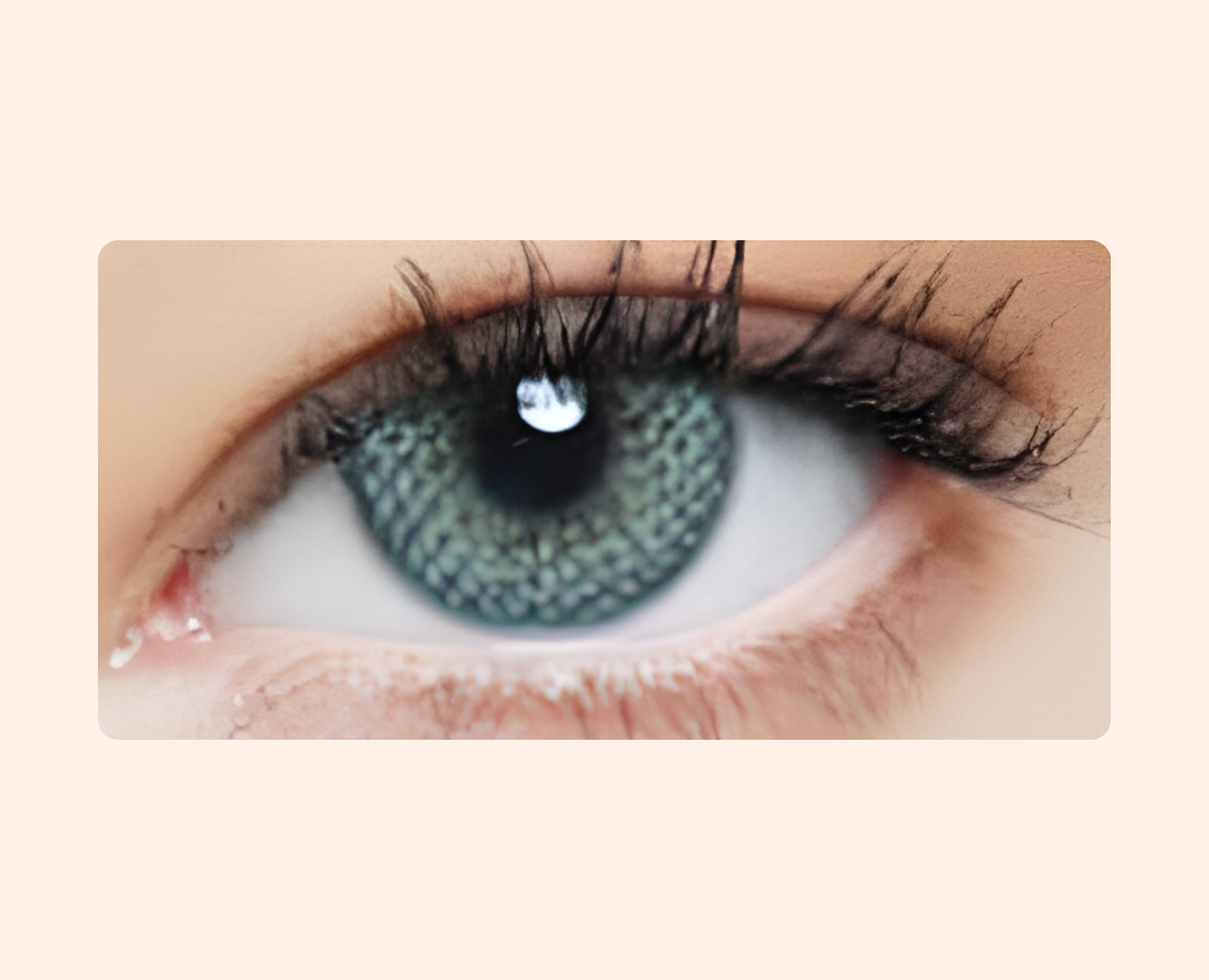 Eye Dia Conventional - S. Blue