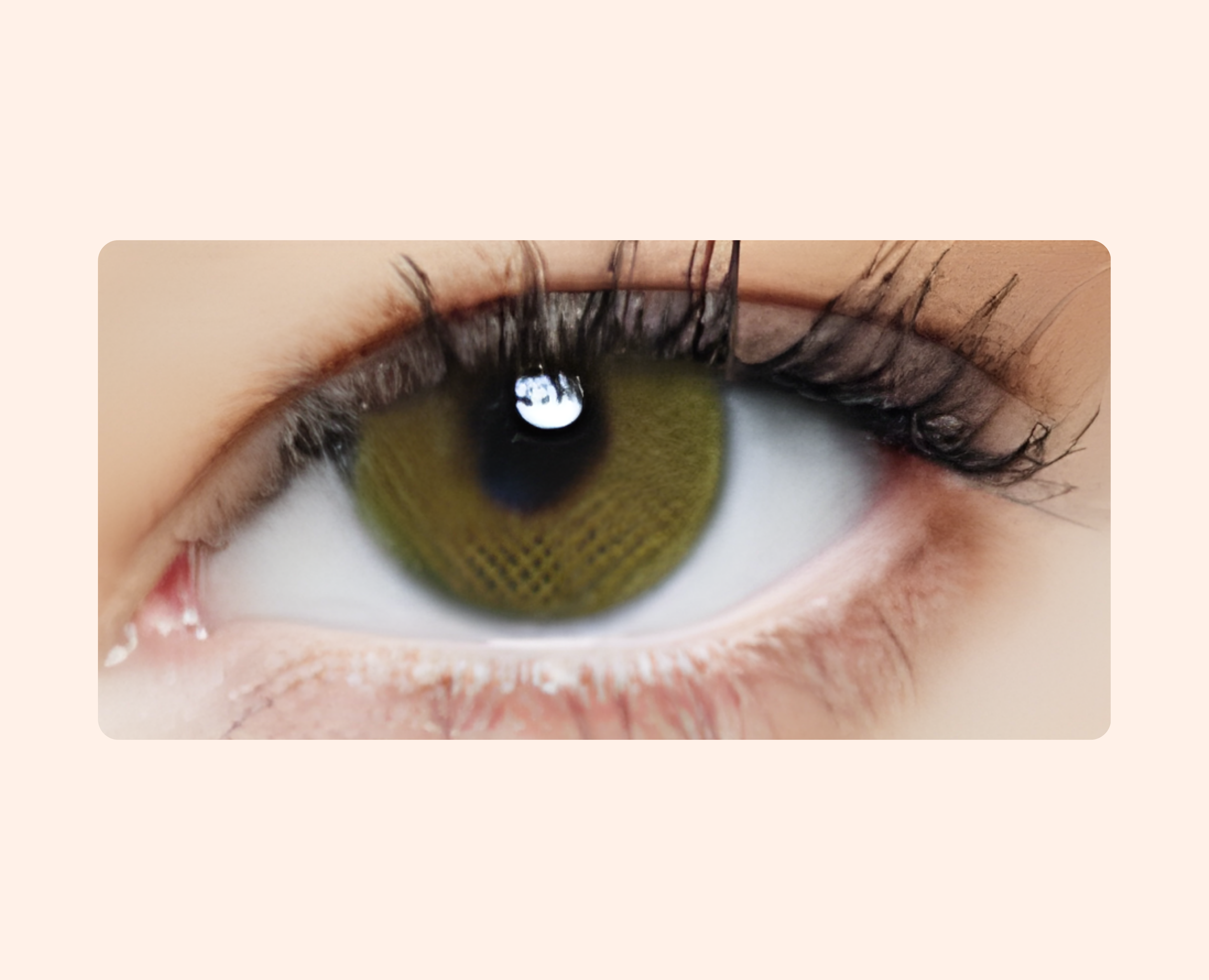 Eye Dia Conventional - S.Brown