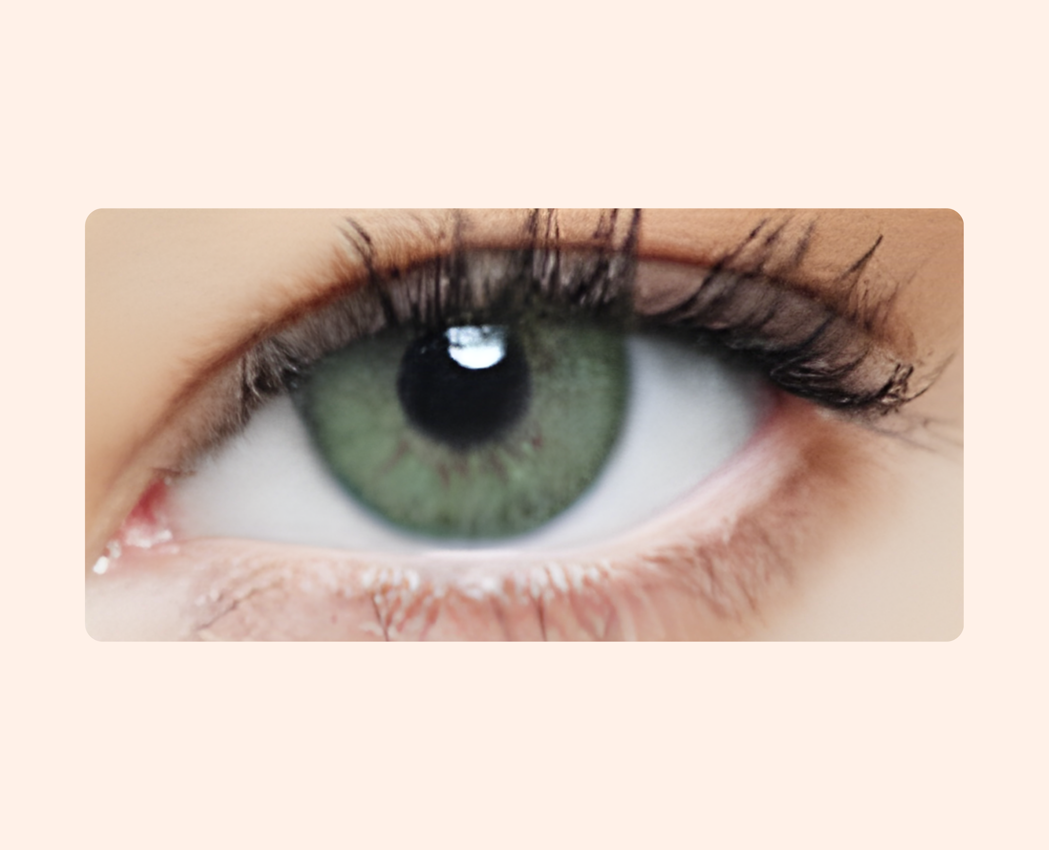 Eye Dia Conventional - Wild Green